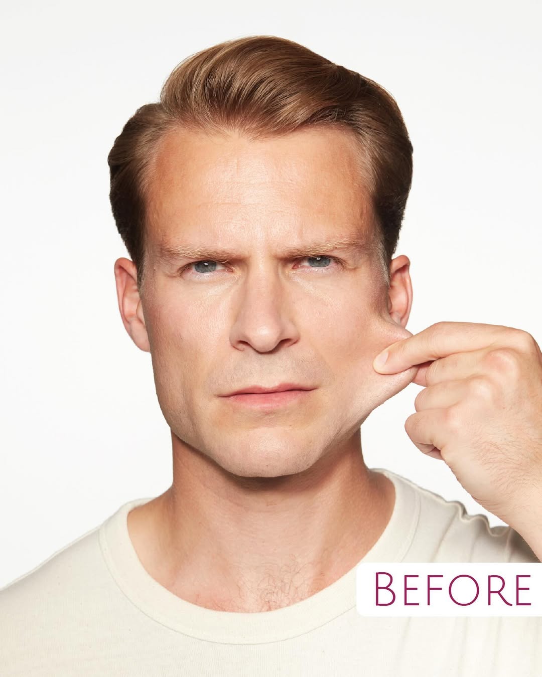 Sculptra® can help you feel like the best version of yourself this holiday season.Starting at th Sculptra® can help you feel like the best version of yourself this holiday season.Starting at th