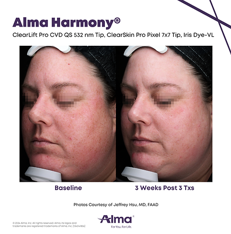 Alma Harmony_B&A_J_Hsu_Q1-24_1345141856_canva (1)