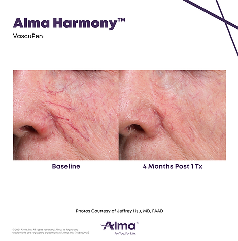 Alma Harmony_B&A_J_Hsu_Q1-24_1408020964_canva