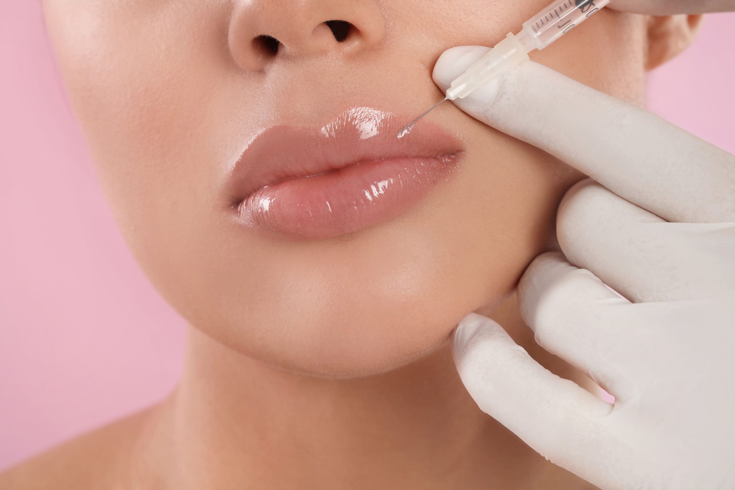 Woman receiving lip filler to enhance lip volume and shape in Oakville