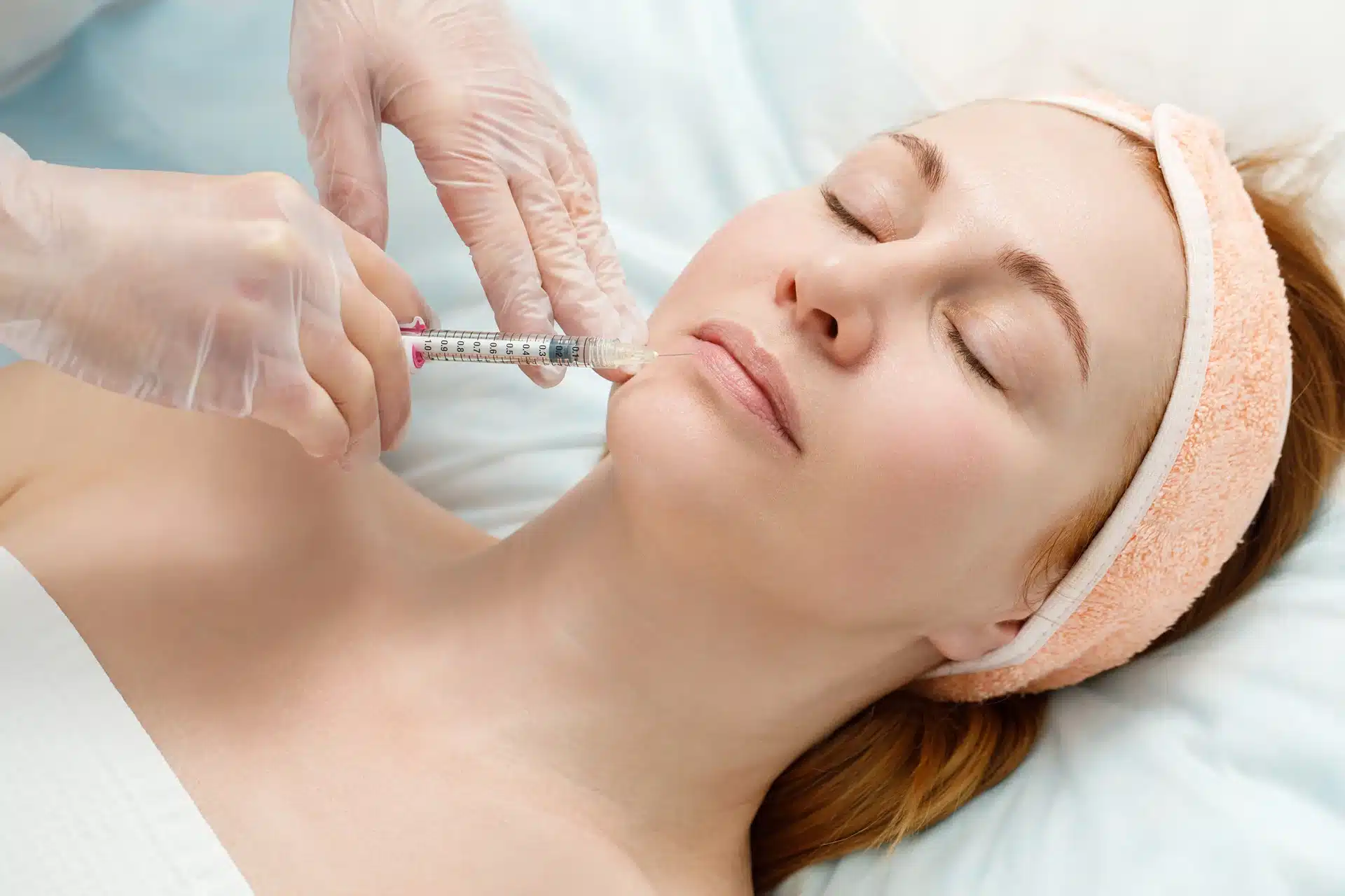 Close-up of softer marionette lines and refreshed mouth corners after filler in Oakville