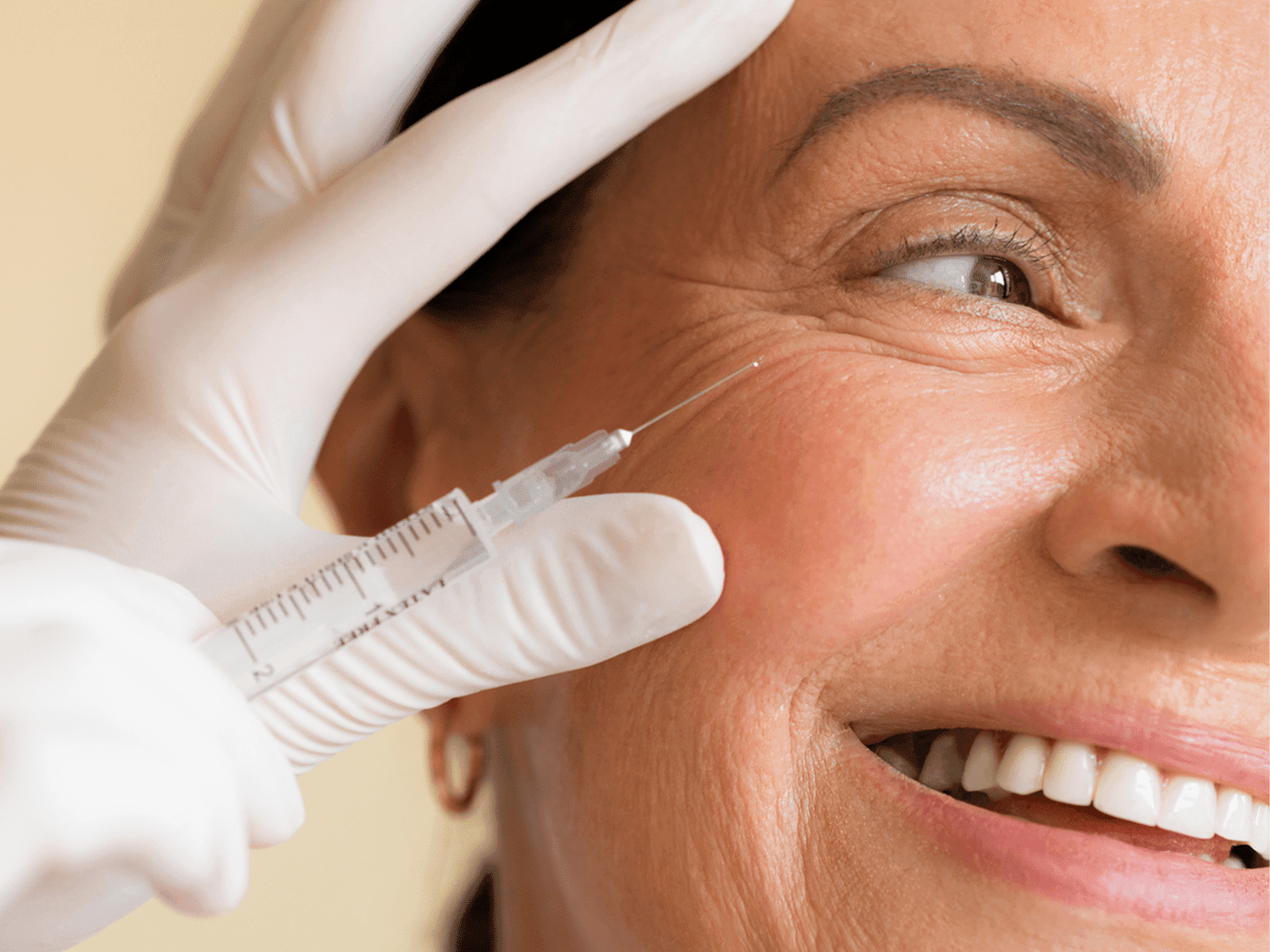 Woman with a natural, expressive look after conservative Botox treatment in Oakville