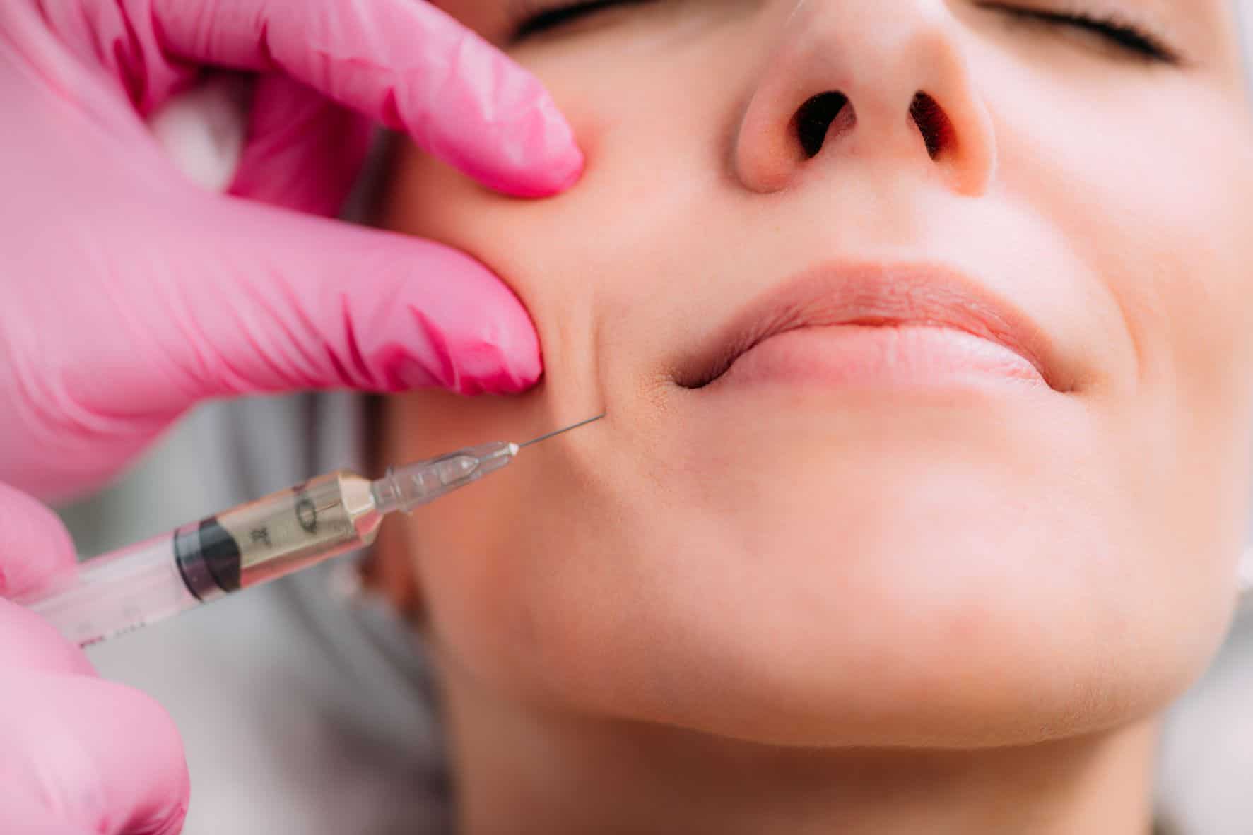 Advanced aesthetic nurse injector performing nasolabial fold filler at Oakville Flawless Cosmetic