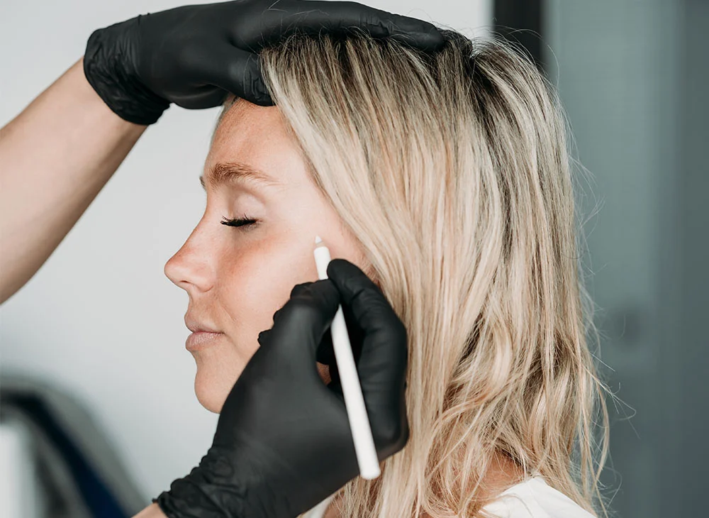 Under-eye filler treatment being performed carefully at an Oakville clinic