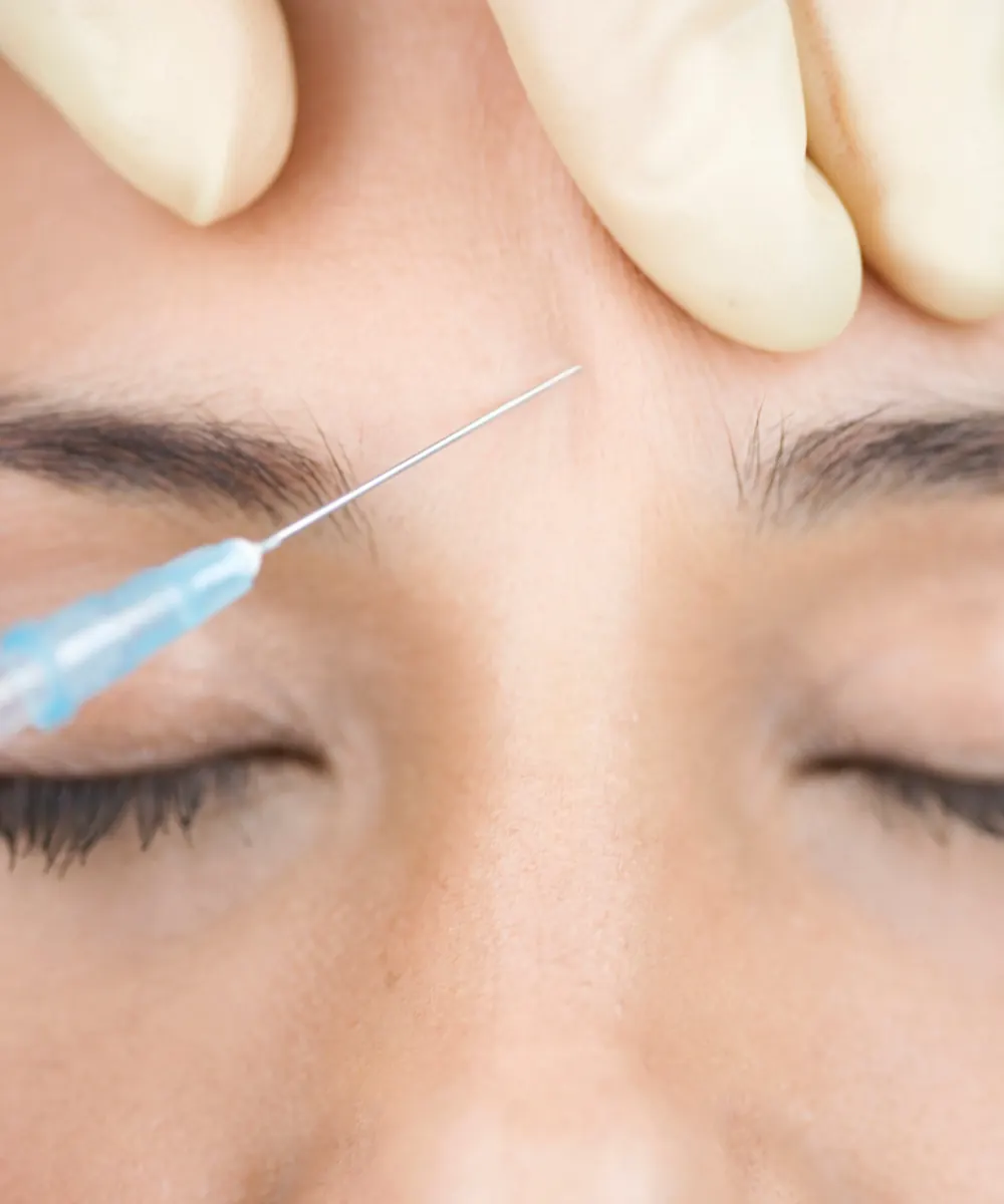 Botox being injected between the brows to soften frown lines in Oakville