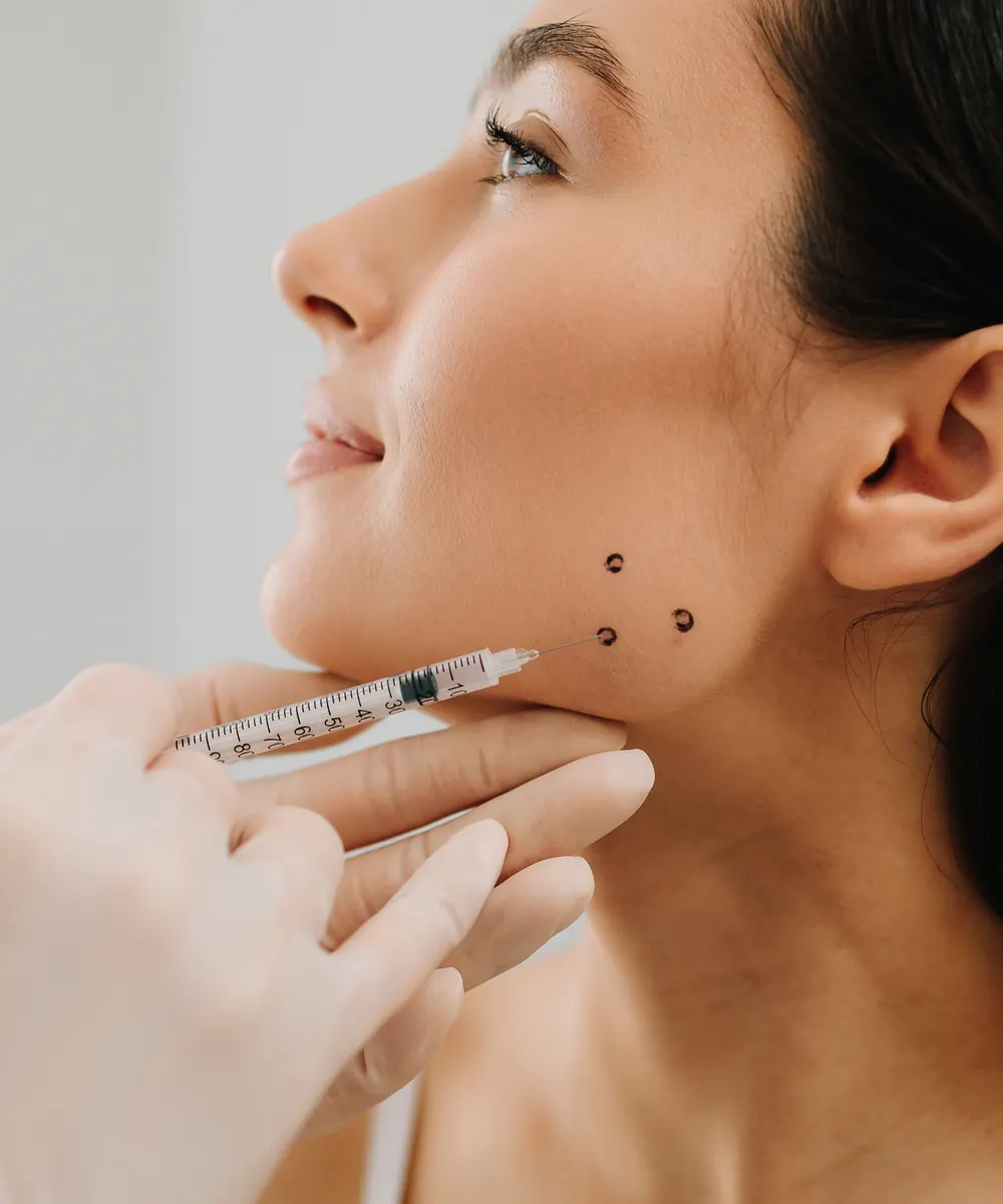 Botox being injected into the masseter jaw muscle in Oakville