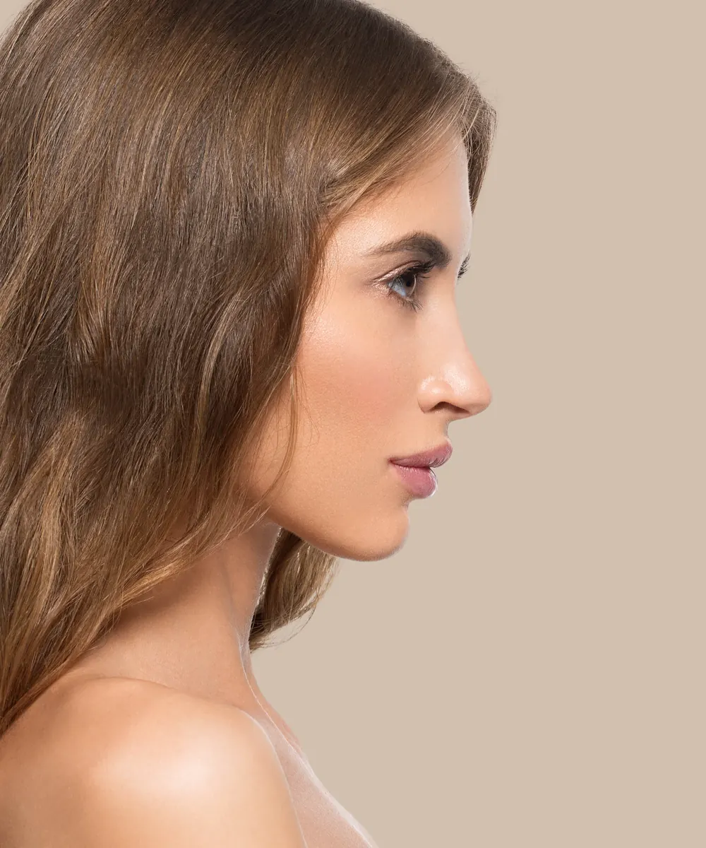Side profile of a woman showing the nasal bridge and tip before treatment