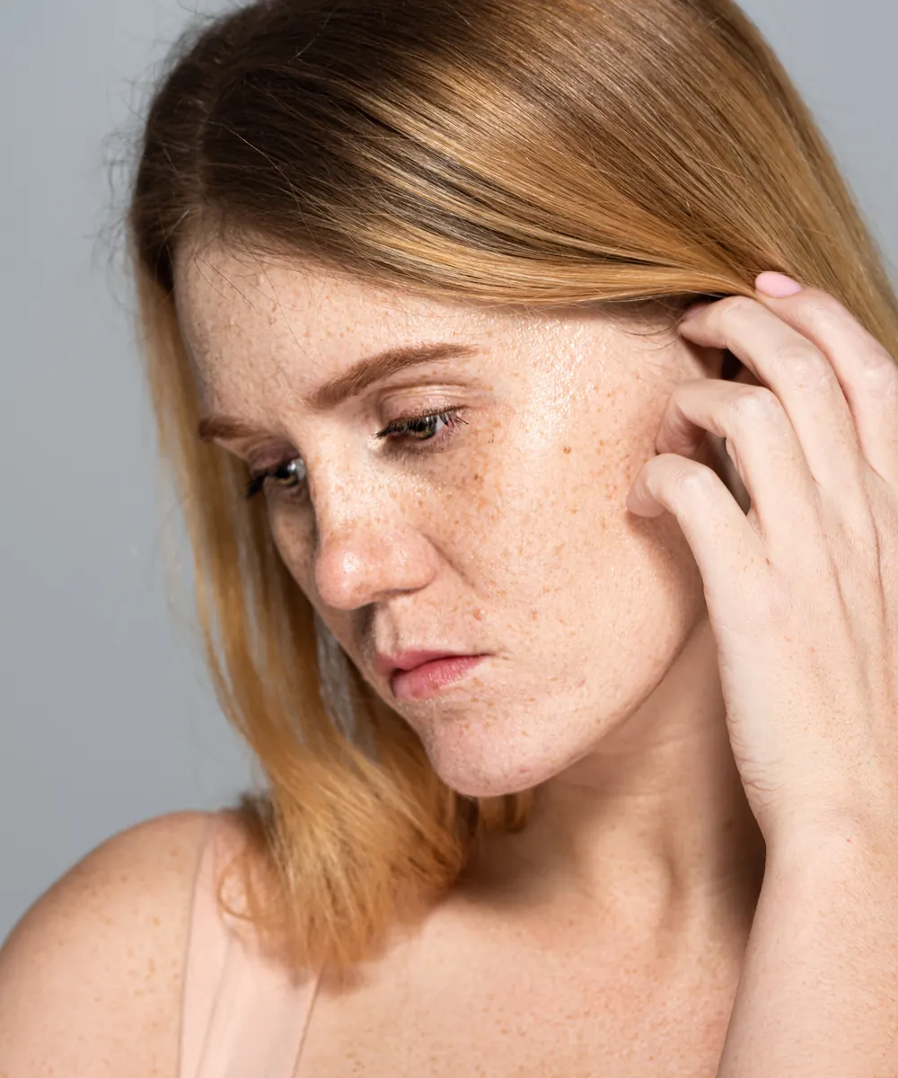 Woman with freckled skin and light facial redness touches her hair, looking down