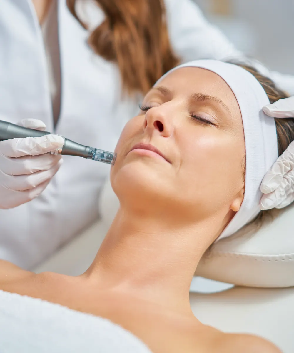 Gloved clinician holds a pen style microneedling device against the cheek of a relaxed woman