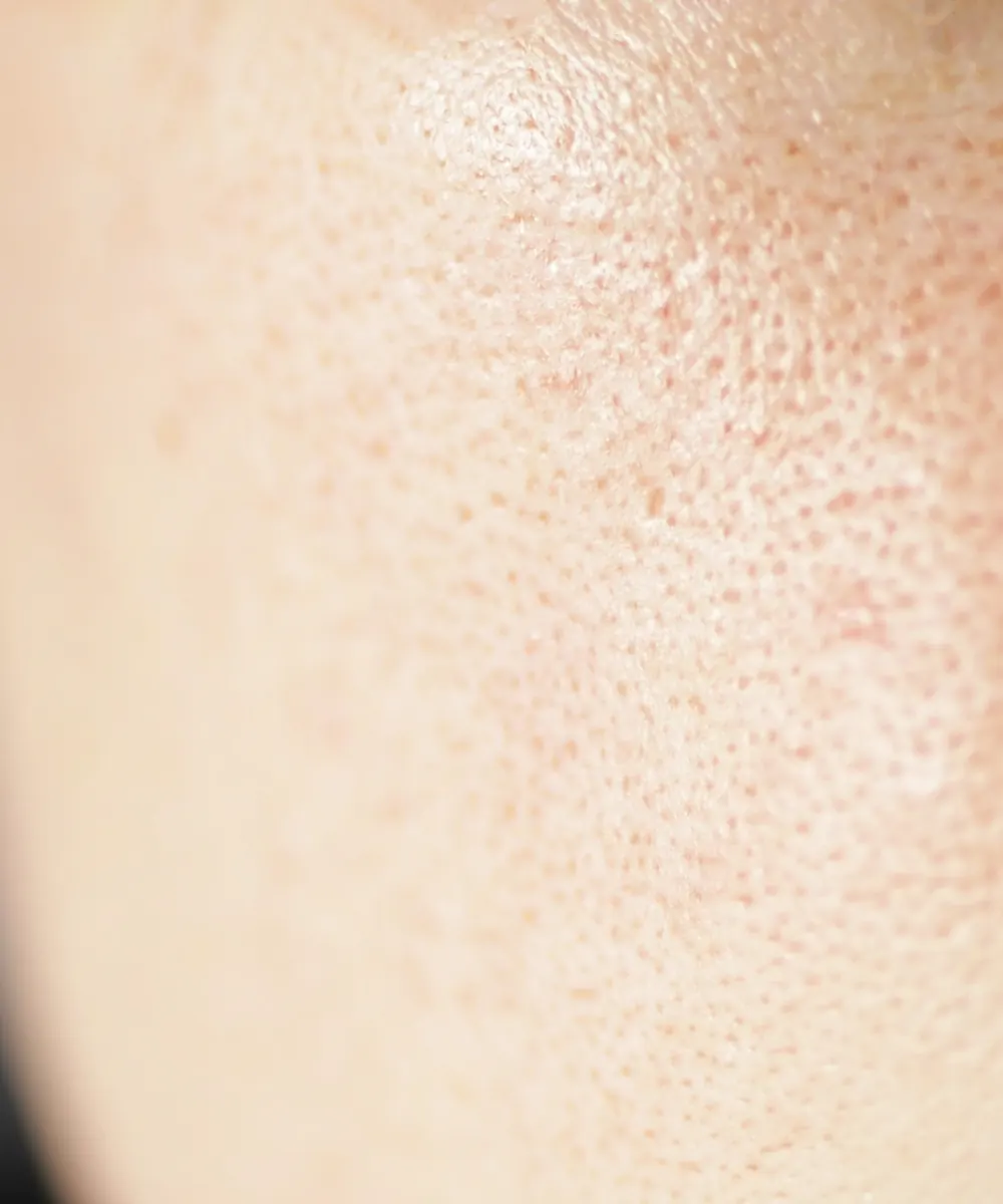 Close view of cheek skin showing visible pores and mild uneven tone